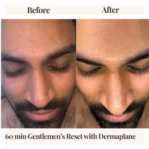 Before and after men's facial Denver