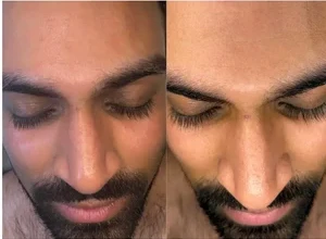 Before and after Gentlemen's Reset Denver